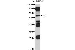 Western blot analysis of extracts of mouse liver, using GGT1 antibody (ABIN5970894) at 1/1000 dilution. (GGT1 anticorps)