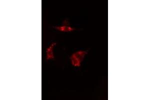 ABIN6277586 staining  HepG2 cells by IF/ICC. (TPT1 anticorps  (Internal Region))
