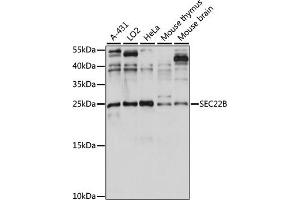 Western blot analysis of extracts of various cell lines, using SEC22B antibody (ABIN7270167) at 1:1000 dilution.