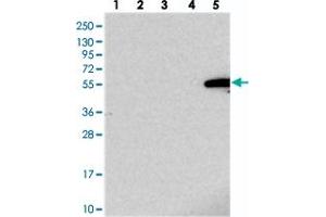 Western blot analysis of Lane 1: RT-4, Lane 2: U-251 MG, Lane 3: Human Plasma, Lane 4: Liver, Lane 5: Tonsil with IGSF11 polyclonal antibody . (IGSF11 anticorps)