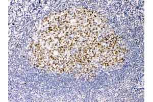 TRF2 was detected in paraffin-embedded sections of human tonsil tissues using rabbit anti- TRF2 Antigen Affinity purified polyclonal antibody (Catalog # ) at 1 µg/mL.