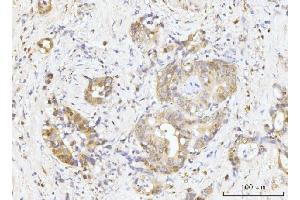 IHC analysis of Nucleostemin/GNL3 using anti-Nucleostemin/GNL3 antibody (ABIN7601778).