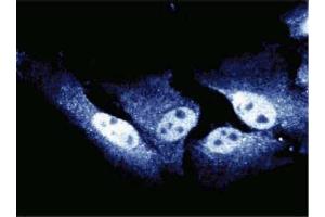 Immunofluorescent staining of HeLa cells. (CDC27 anticorps  (AA 145-343))