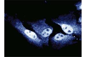 Immunofluorescent staining of HeLa cells.