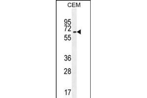 UNCX Antibody (C-term) (ABIN655115 and ABIN2844746) western blot analysis in CEM cell line lysates (35 μg/lane). (UNCX anticorps  (C-Term))