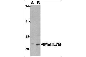 Western blot analysis of MettL7B in rat spleen tissue lysate with MettL7B antibody at (A) 2 and (B) 4 µg/ml (METTL7B anticorps  (C-Term))