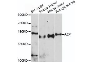 Western blot analysis of extracts of various cell lines, using A2M antibody (ABIN5970754) at 1/500 dilution. (alpha 2 Macroglobulin anticorps)