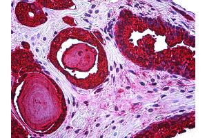 Anti-KLK3 / PSA antibody IHC of human prostate.
