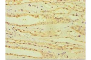 Immunohistochemistry of paraffin-embedded human kidney tissue using ABIN7144871 at dilution of 1:100