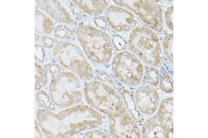 Immunohistochemistry of paraffin-embedded Mouse kidney using RPS18 antibody (ABIN6128660, ABIN6147205, ABIN6147206 and ABIN6215379) at dilution of 1:100 (40x lens).