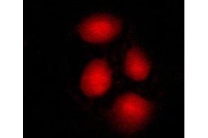 ABIN6269115 staining MCF-7 cells by ICC/IF.