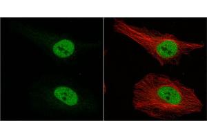 ICC/IF Image MSI1 antibody [N3C3] detects MSI1 protein at nucleus by immunofluorescent analysis.