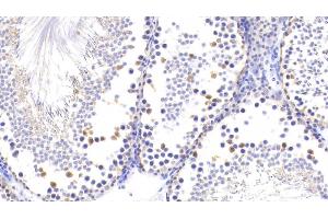 Detection of UCHL1 in Rat Testis Tissue using Polyclonal Antibody to Ubiquitin Carboxyl Terminal Hydrolase L1 (UCHL1)