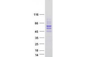 Validation with Western Blot