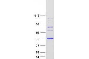 Validation with Western Blot