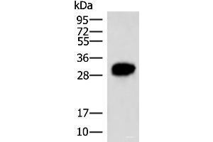 Western blot analysis of HepG2 cell lysate using HCCS Polyclonal Antibody at dilution of 1:4000 (HCCS anticorps)