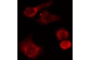 ABIN6277662 staining HuvEc cells by IF/ICC. (LSP1 anticorps  (C-Term))