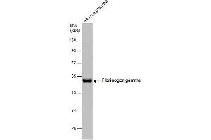WB Image Mouse tissue extract (50 μg) was separated by 10% SDS-PAGE, and the membrane was blotted with Fibrinogen gamma antibody , diluted at 1:500.