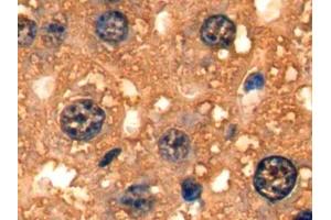 Detection of FABP1 in Mouse Liver Tissue using Polyclonal Antibody to Fatty Acid Binding Protein 1 (FABP1)