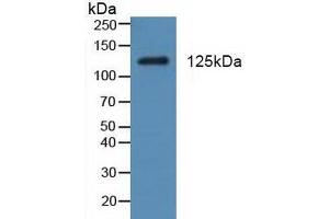 Figure. (PDGFRA anticorps  (AA 170-387))