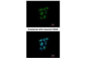 ICC/IF Image Immunofluorescence analysis of paraformaldehyde-fixed A431, using NR0B2, antibody at 1:500 dilution. (NR0B2 anticorps)