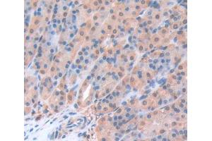 Used in DAB staining on fromalin fixed paraffin- embedded Kidney tissue