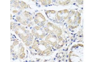 Immunohistochemistry of paraffin-embedded Human stomach using OPA3 Polyclonal Antibody at dilution of 1:100 (40x lens).