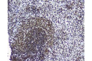 IHC analysis of TPR using anti-TPR antibody (ABIN5693275). (TPR anticorps)