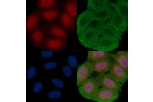 ABIN6261112 and ABIN6277999 staining Hela cells(30 min of UV treatment) by IF/ICC. (Cullin 4B anticorps  (N-Term))