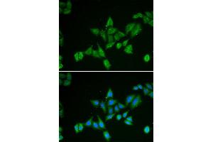 Immunofluorescence (IF) image for anti-BCL2/adenovirus E1B 19kDa Interacting Protein 2 (BNIP2) antibody (ABIN1980298) (BNIP2 anticorps)
