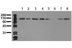 Western Blotting (WB) image for anti-Catenin (Cadherin-Associated Protein), alpha 1, 102kDa (CTNNA1) antibody (ABIN126738) (CTNNA1 anticorps)