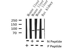Western blot analysis of Phospho-IKK alpha (Thr23) expression in various lysates