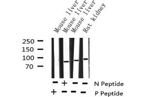 Western blot analysis of Phospho-IKK alpha (Thr23) expression in various lysates (IKK alpha anticorps  (pThr23))