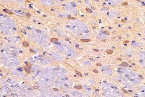 Immunohistochemistry analysis of paraffin-embedded mouse brain using,DAK (ABIN7073737) at dilution of 1: 5000 (DAK anticorps)