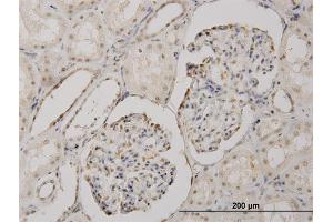 Immunoperoxidase of monoclonal antibody to CSDA on formalin-fixed paraffin-embedded human kidney.