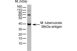 Western Blotting (WB) image for anti-Mycobacterium Tuberculosis (CFP10) antibody (ABIN316622) (CFP10 anticorps)