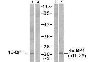Western blot analysis of extracts from MDA-MB-435 cells, untreated or EGF-treated (200 ng/ml, 30min), using 4E-BP1 (Ab-36) antibody (E021215, Lane 1 and 2) and 4E-BP1 (phospho-Thr36) antibody (E011222, Lane 3 and 4). (eIF4EBP1 anticorps  (pThr36))