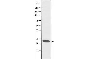 Western blot analysis of extracts from A549 cells, using MRPL13 antibody. (MRPL13 anticorps  (C-Term))