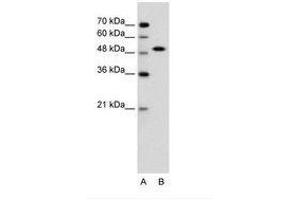 Image no. 1 for anti-SRY (Sex Determining Region Y)-Box 11 (SOX11) (N-Term) antibody (ABIN6736606)