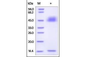Rat FcRn / FCGRT & B2M on SDS-PAGE under reducing (R) condition.