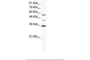 Image no. 1 for anti-ALX Homeobox 4 (ALX4) (AA 31-80) antibody (ABIN202460) (ALX4 anticorps  (AA 31-80))
