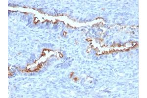 Formalin-fixed, paraffin-embedded human Endometrium stained with Podocalyxin Mouse Monoclonal Antibody (PODXL/2184). (PODXL anticorps  (AA 310-447))
