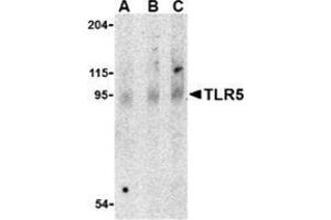 Western blot analysis of TLR5 in rat brain cell lysate with this product at (A) 0. (TLR5 anticorps  (Center))