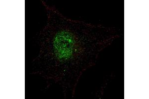 Fluorescent confocal image of SY5Y cells stained with phospho-PDX1-T11 antibody. (PDX1 anticorps  (pThr11))