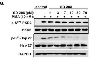SD-208 inhibited prostate cancer cells proliferation, survival, and invasion and the anti-proliferative effect of SD-208 was mediated through the inhibition of PKD.