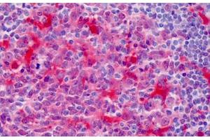 Human Tonsil: Formalin-Fixed, Paraffin-Embedded (FFPE)