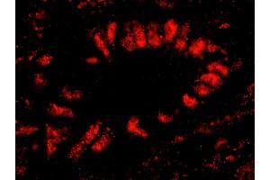 Immunofluorescence (IF) image for anti-Splicing Factor 3b, Subunit 2, 145kDa (SF3B2) (AA 775-825) antibody (ABIN7449024)
