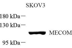 Western blot analysis of MECOM (ABIN7074575) at dilution of 1: 500 (MECOM anticorps)