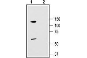 Western blotting of rat brain membranes:  - 1.