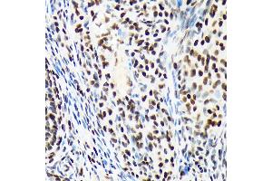 Immunohistochemistry of paraffin-embedded rat ovary using A Rabbit mAb (ABIN7265699) at dilution of 1:100 (40x lens). (ARID1A anticorps)